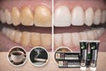 Clever Doctor Bamboo Charcoal Toothpaste - Image 2